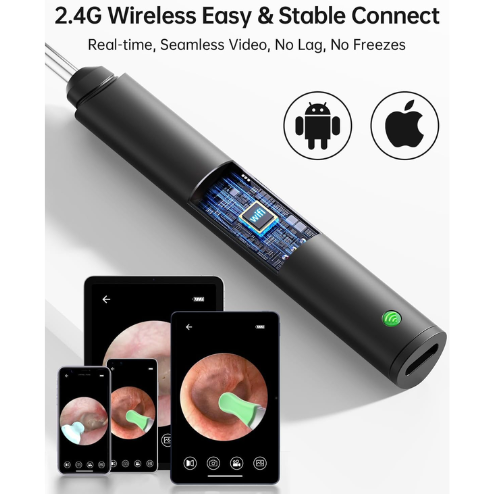 Limpiador de Oídos con Cámara